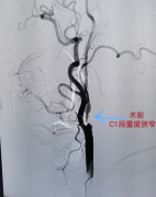 菏泽医专附属医院