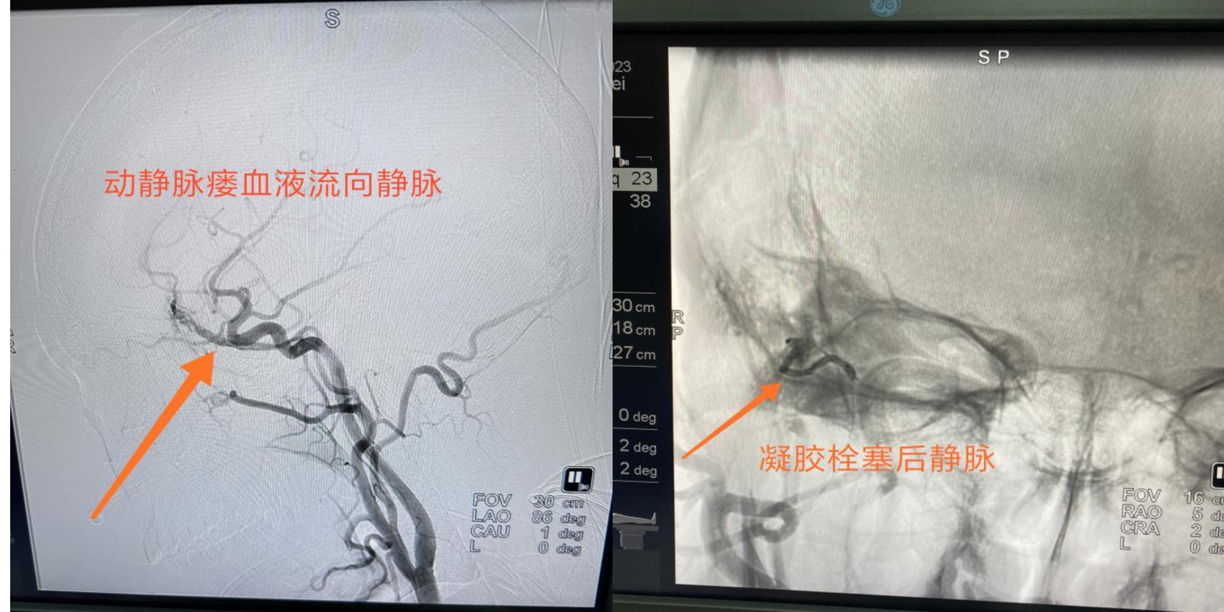 菏泽医专附属医院