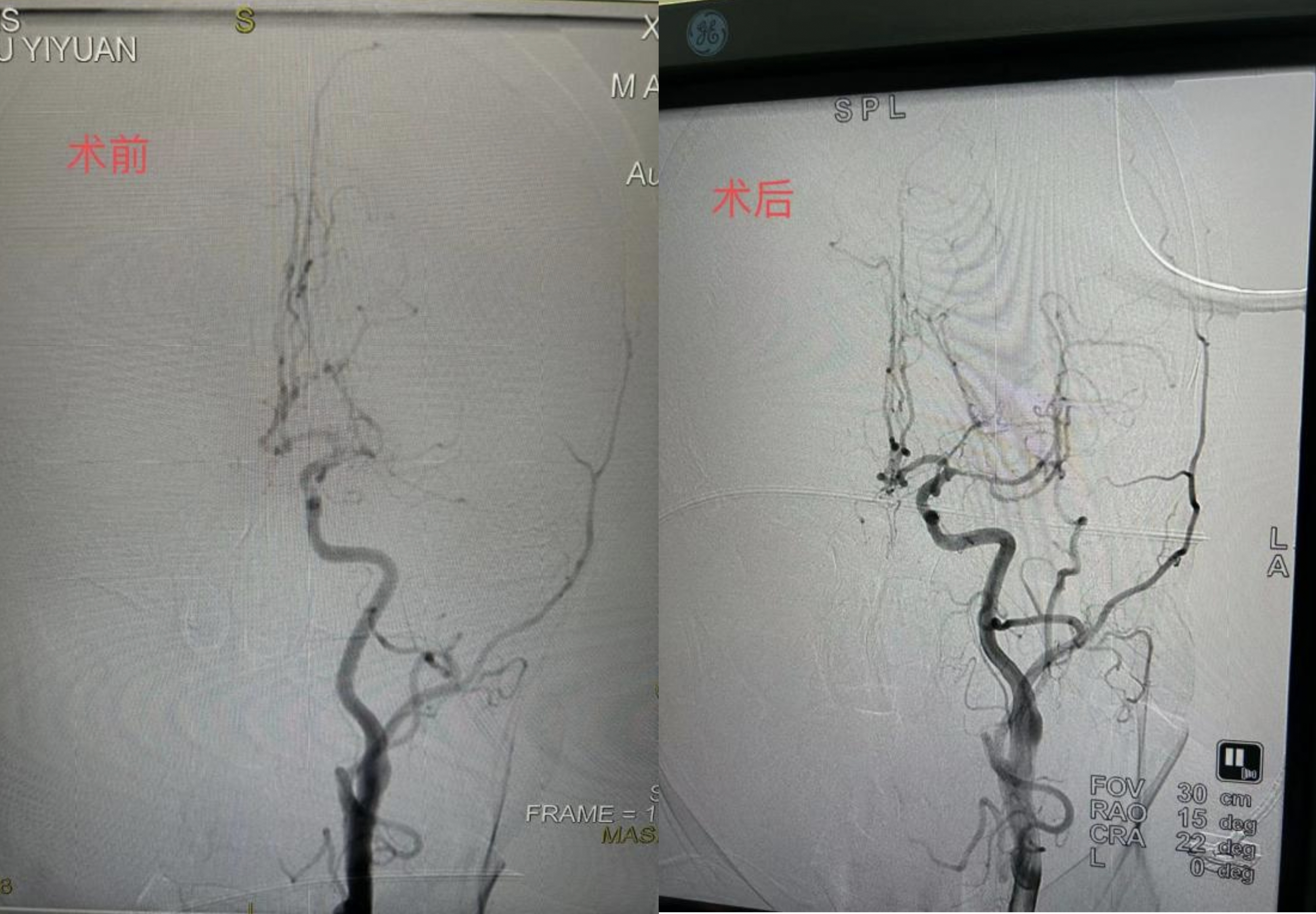 菏泽医专附属医院